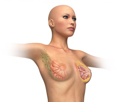 Breast Reduction by OrangeCountySurgeons